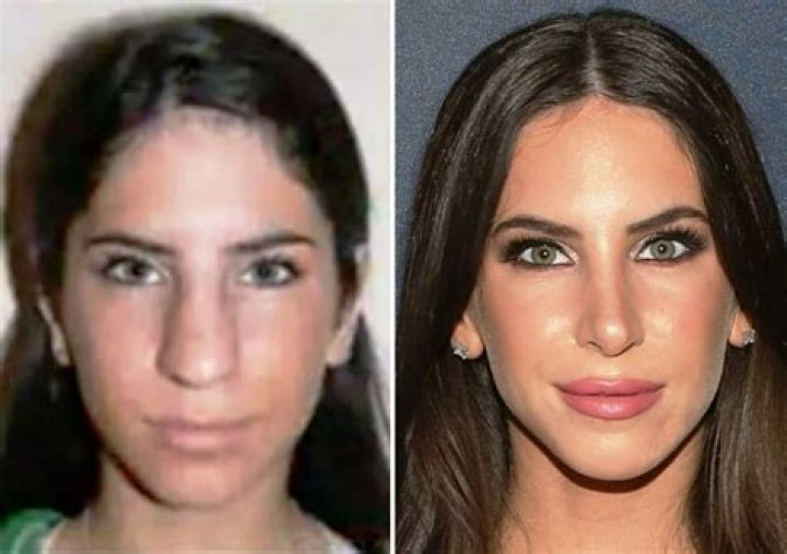 Has Jen Selter Undergo Nose Job? Before And After Surgery Photos On IG