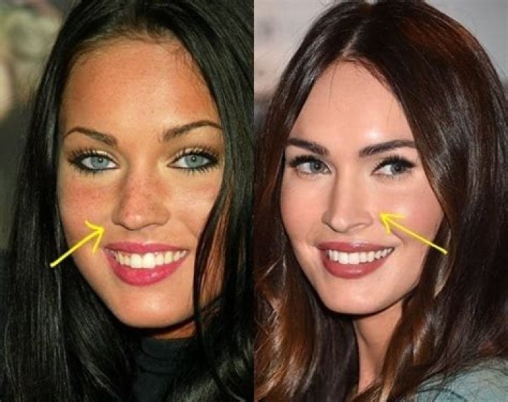 MSNBC Yasmin Vossoughian Mouth: What’s Wrong With Her Face And Did She Get A Plastic Surgery?