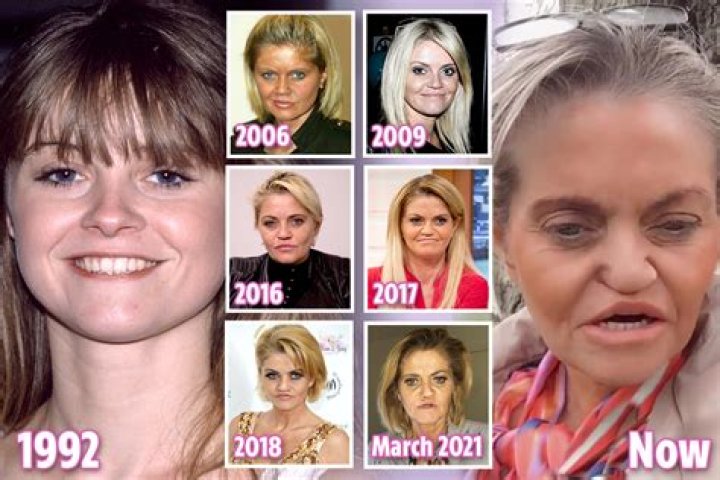 What Happened To Danniella Westbrook Septum? Timeline Of Everything She Has Done On Her Face